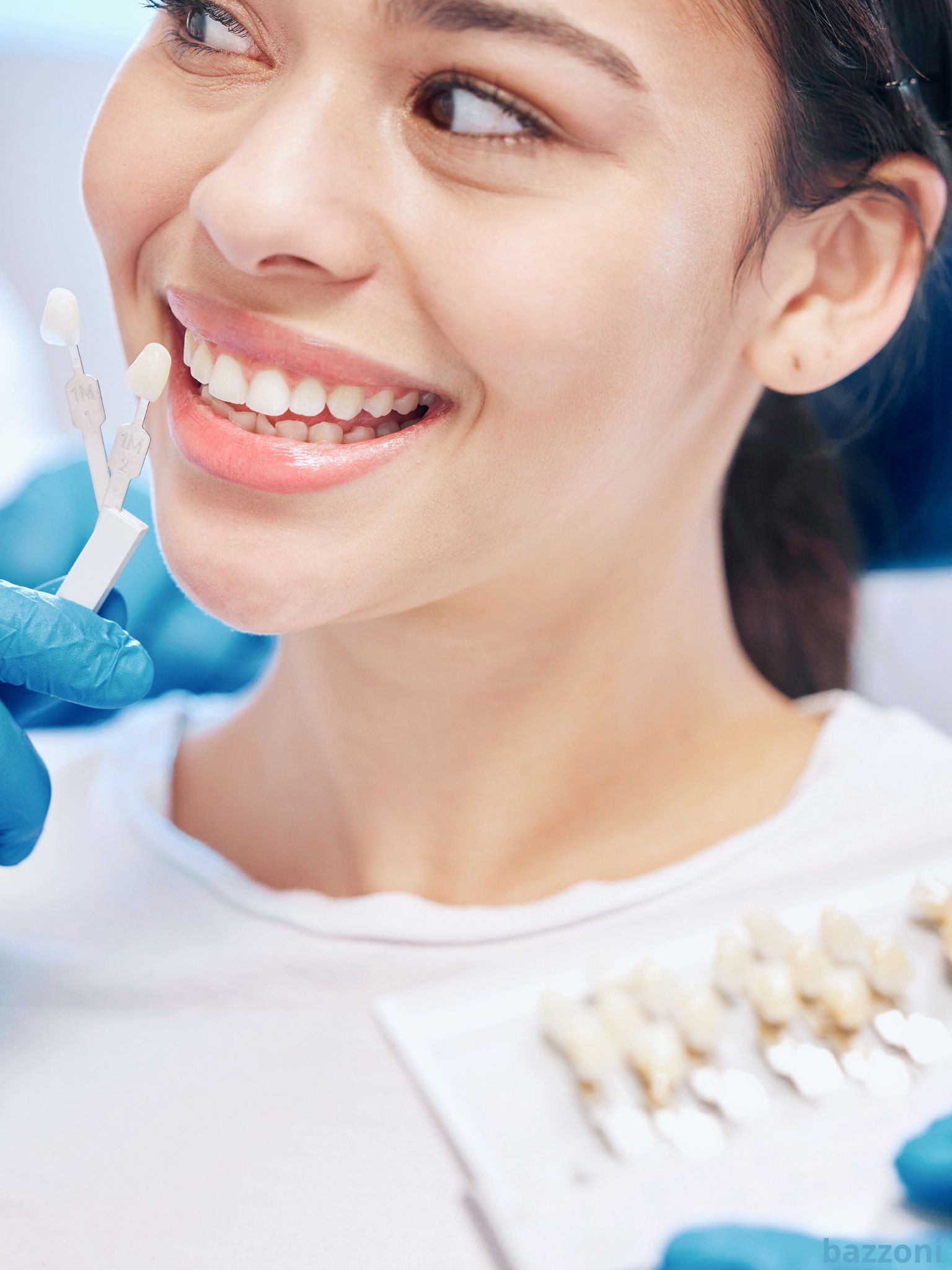 Faccette Dentali Studio Dentistico Bazzoni