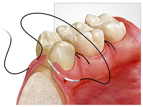 Chirurgia Orale Studio Dentistico Bazzoni
