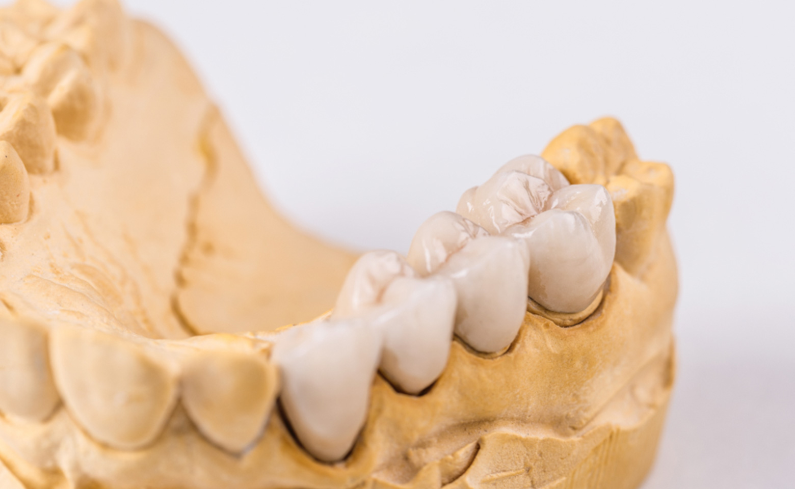 Protesi Studio Dentistico Bazzoni